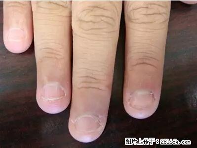 剪指甲、挖耳屎，这些日常小动作竟隐藏大危害！ - 襄樊生活资讯 - 襄樊28生活网 xf.28life.net